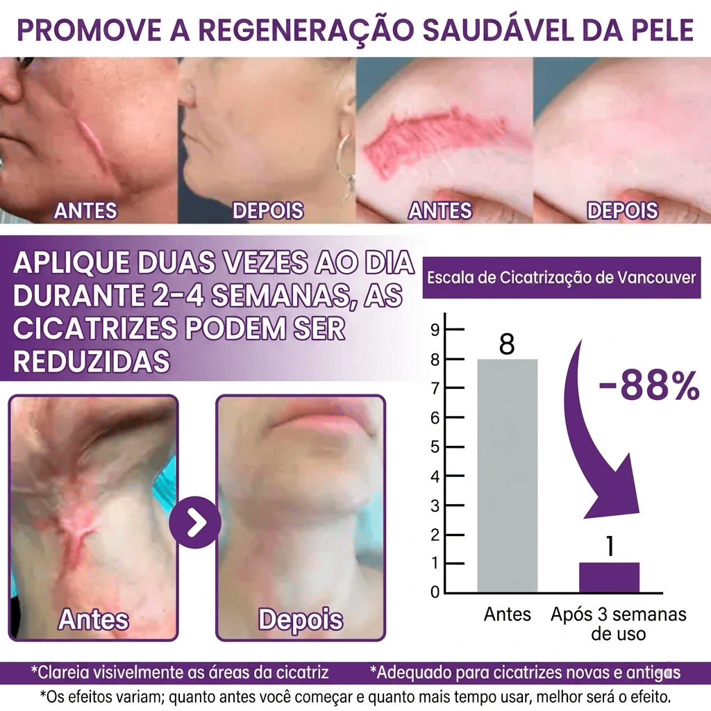 Por que tantas pessoas escolhem
